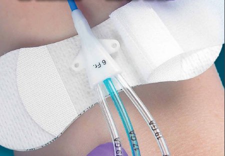 GRIP-LOKÂ® Universal Securement Device