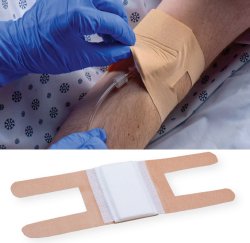 IV-ARMORÂ® IV Dressing, 10 x 2Â¾ Inch