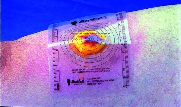 Trademark Medical Wound Measuring Guide