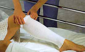 AlbaHealthÂ® White Polyester Tubular Stockinette, 4 Inch x 25 Yard