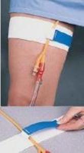 Cath-Mate Â¨ II Leg Stap