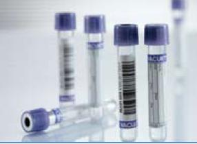 VACUETTE® Venous Blood Collection Tube K3 EDTA Additive 13 X 75 mm 3 mL Lavender / Black Ring Pull Cap Polyethylene Terephthalate (PET) Tube