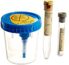 BD VacutainerÂ¨ Urine Specimen Collection Kit