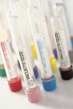VACUETTE® Venous Blood Collection Tube K2 EDTA Additive 13 X 100 mm 6 mL Lavender / Black Ring Pull Cap Polyethylene Terephthalate (PET) Tube