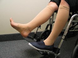 GeriLegÂ¨ Protective Leg Sleeve