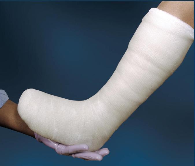 CutimedÂ¨ Off-Loader Select Total Contact Cast System