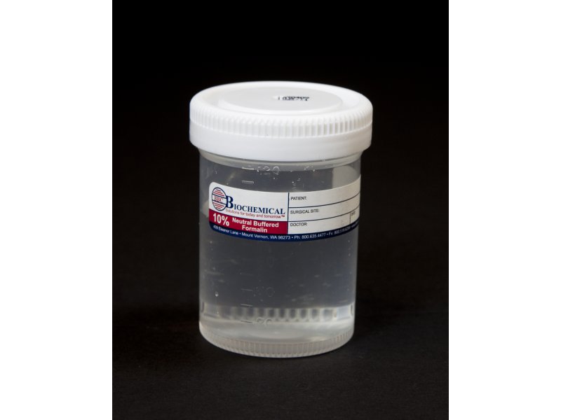 BBC Biochemical Trans-PakÂª Prefilled Formalin Container