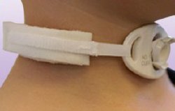 Marpac Tracheostomy Tube Collar