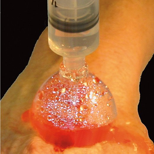 Zerowet Splash Shield